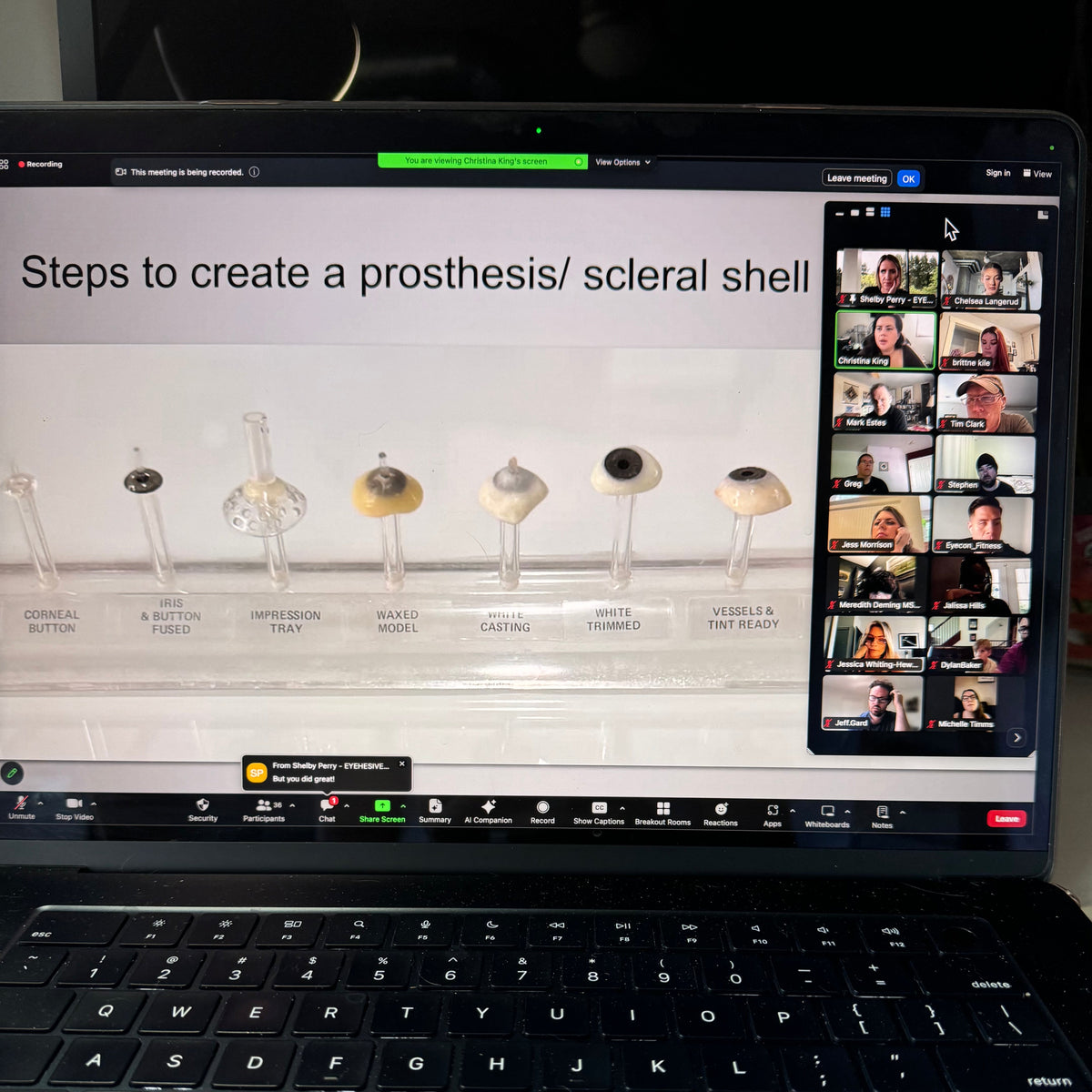how a prosthetic eye is made